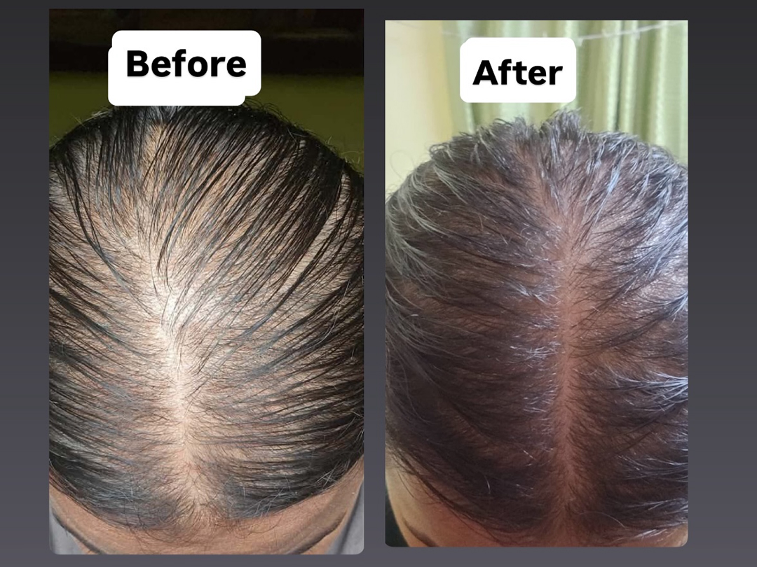 Client result