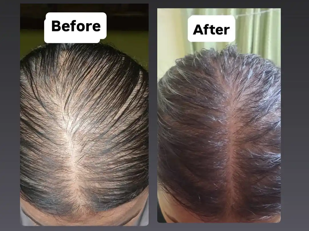 Client result