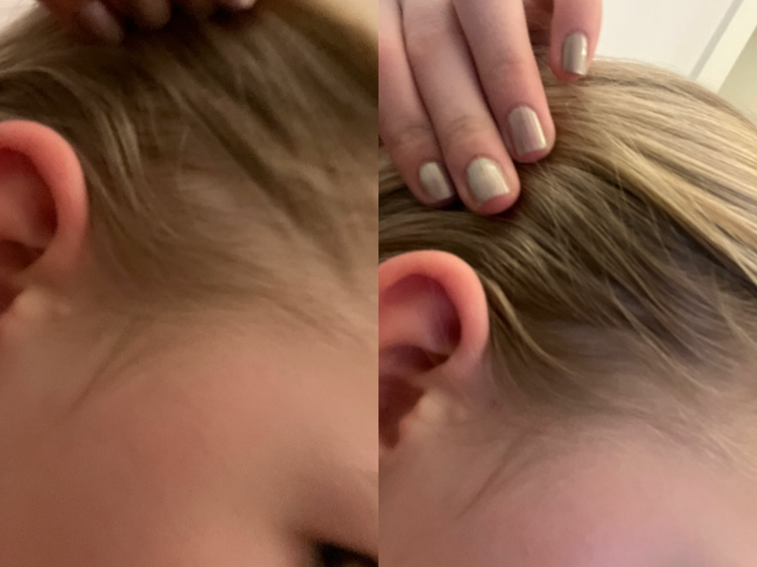 Client result