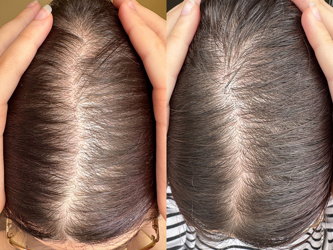 Client result